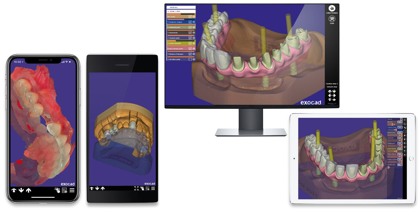 exocad Ultimate Lab Bundle
