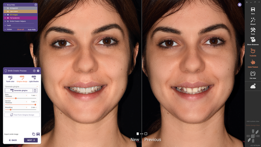 exocad Clinical Print Package (Flex Only)